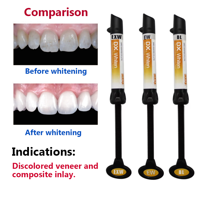 Resin Komposit Gigi Enamel Lig - Teeth Whitening Veneers ulasan dan harga