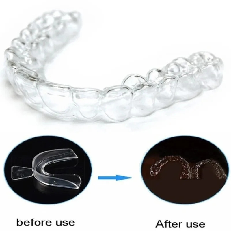 1/3/6 Pasang Pelindung Mulut S - Teeth Whitening Mouth Guard ulasan dan harga