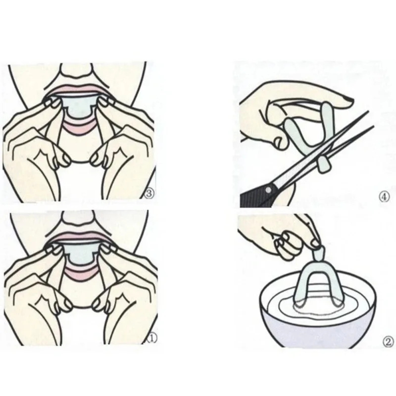1/3/6 Pasang Pelindung Mulut S - Teeth Whitening Mouth Guard ulasan dan harga