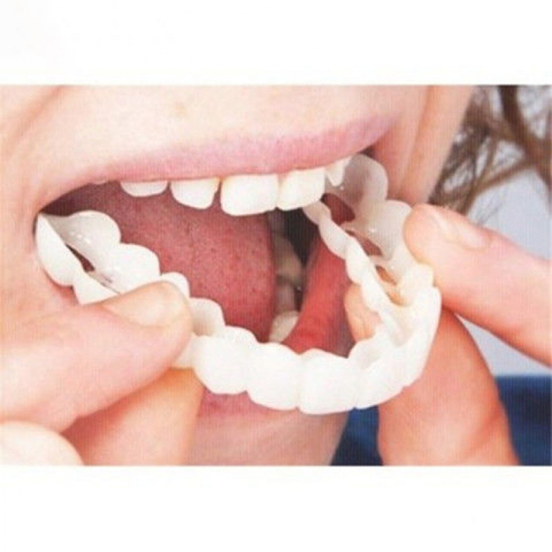 Penutup Gigi Palsu Cocok Sempu - Teeth Whitening Veneers ulasan dan harga