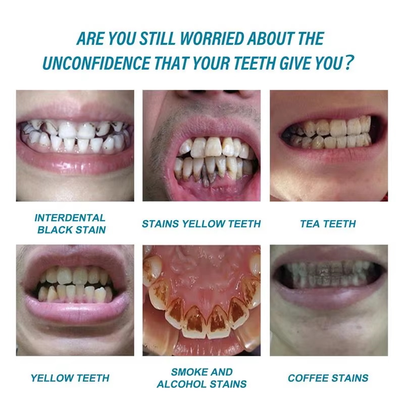 Esensi Pemutih Gigi Menghilang - Teeth Whitening Serum ulasan dan harga