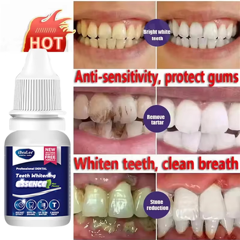 Esensi Pemutih Gigi Menghilang - Teeth Whitening Serum ulasan dan harga