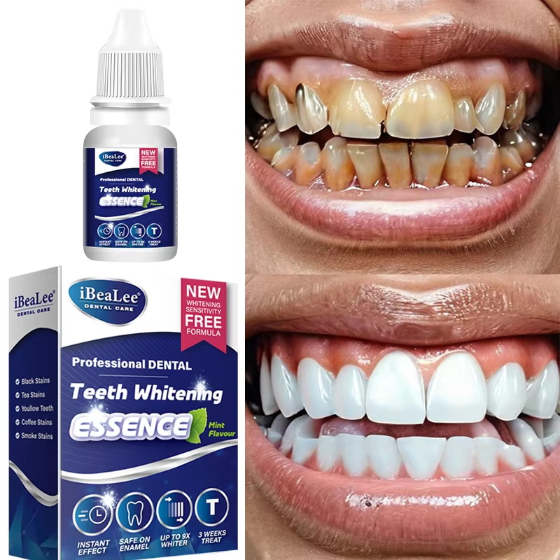 Esensi Pemutih Gigi Menghilang - Teeth Whitening Serum ulasan dan harga