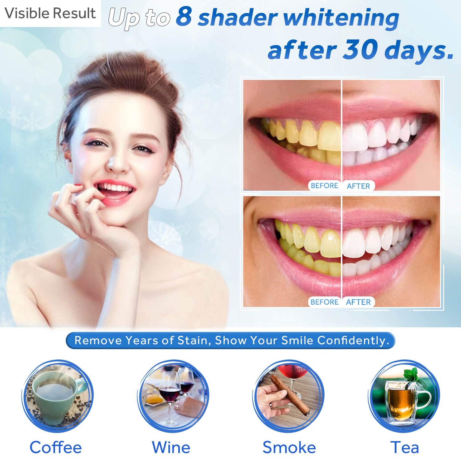 Gel Pemutih Gigi Isi Ulang Syr - Teeth Whitening Hismile ulasan dan harga