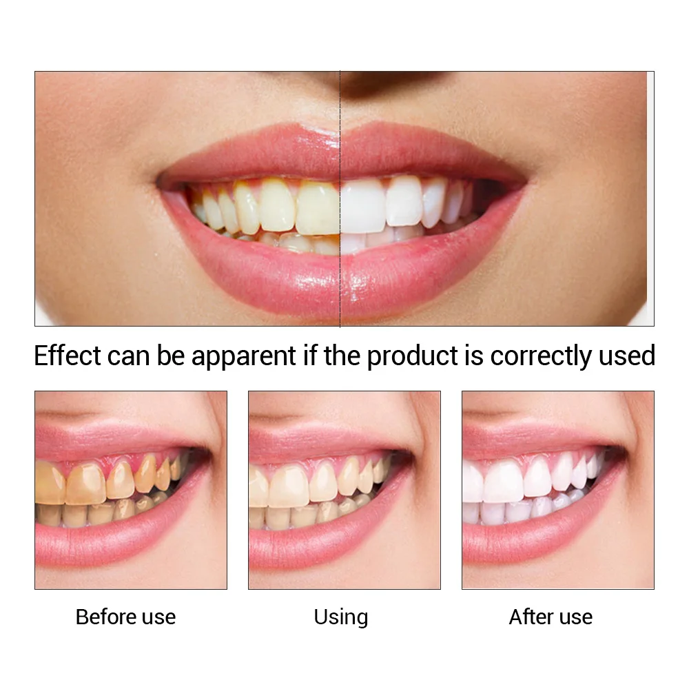FTEENPLY Bubuk Esensi Pemutih  - Teeth Whitening Results ulasan dan harga