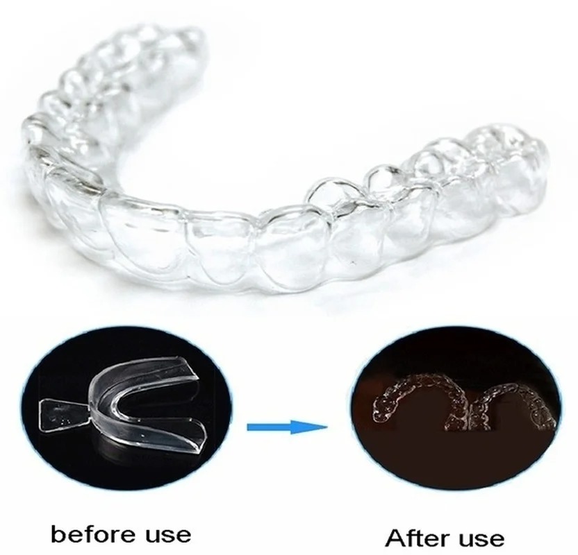 Pelindung mulut tidur Anti men - Teeth Whitening Mouth Guard ulasan dan harga