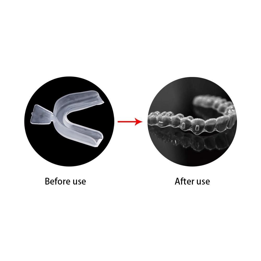 Pelindung Gigi Bruxism, Penutu - Teeth Whitening Mouth Guard ulasan dan harga