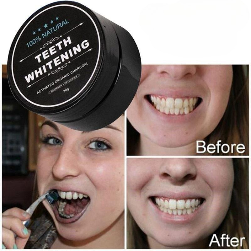 1 Kotak Bubuk Pemutih Gigi Ara - Teeth Whitening Filter ulasan dan harga