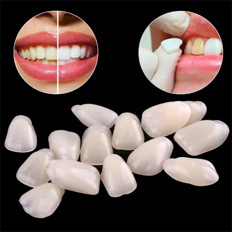 Veneer Gigi Sementara - Penutu - Teeth Whitening Veneers ulasan dan harga