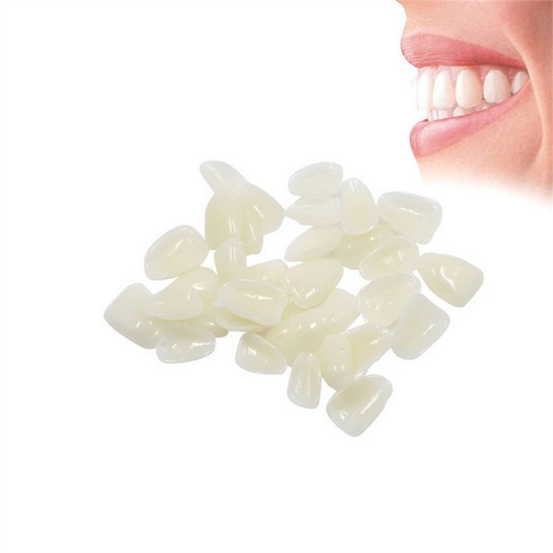 Veneer Gigi Sementara - Penutu - Teeth Whitening Veneers ulasan dan harga