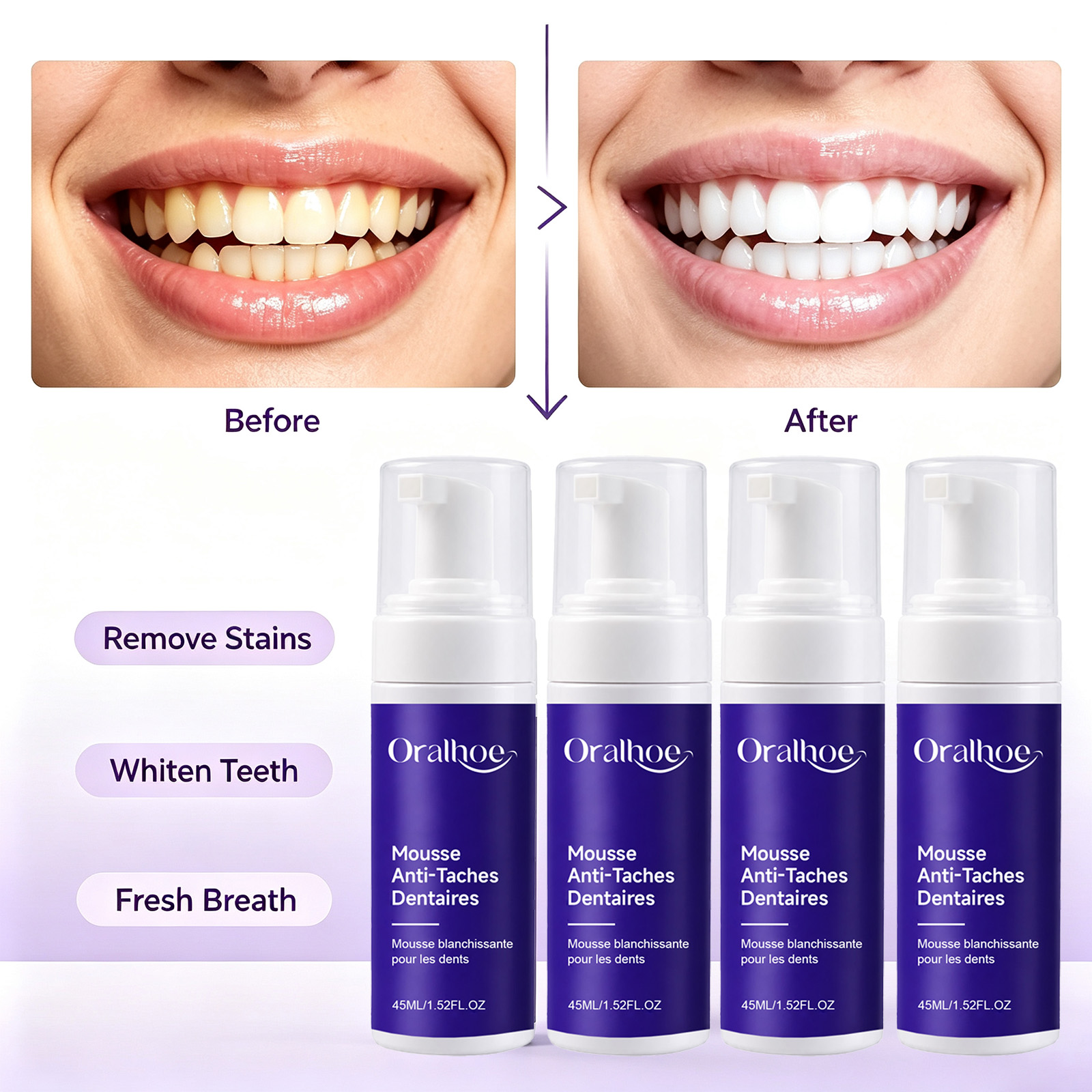 Pasta Gigi Pemutih Gigi Berbus - Teeth Whitening Routine ulasan dan harga