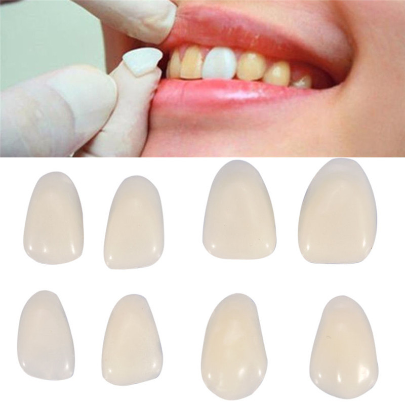 Gigi Palsu Sementara Mahkota G - Teeth Whitening Veneers ulasan dan harga