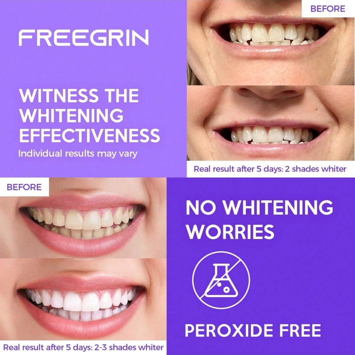 Stiker Gigi Pemutih Mewah 7/14 - Teeth Whitening Results ulasan dan harga