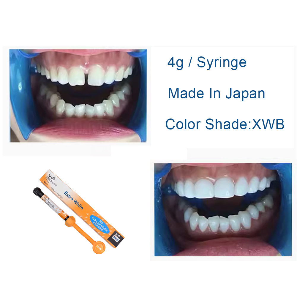 Resin Komposit Gigi Extra Whit - Teeth Whitening Veneers ulasan dan harga
