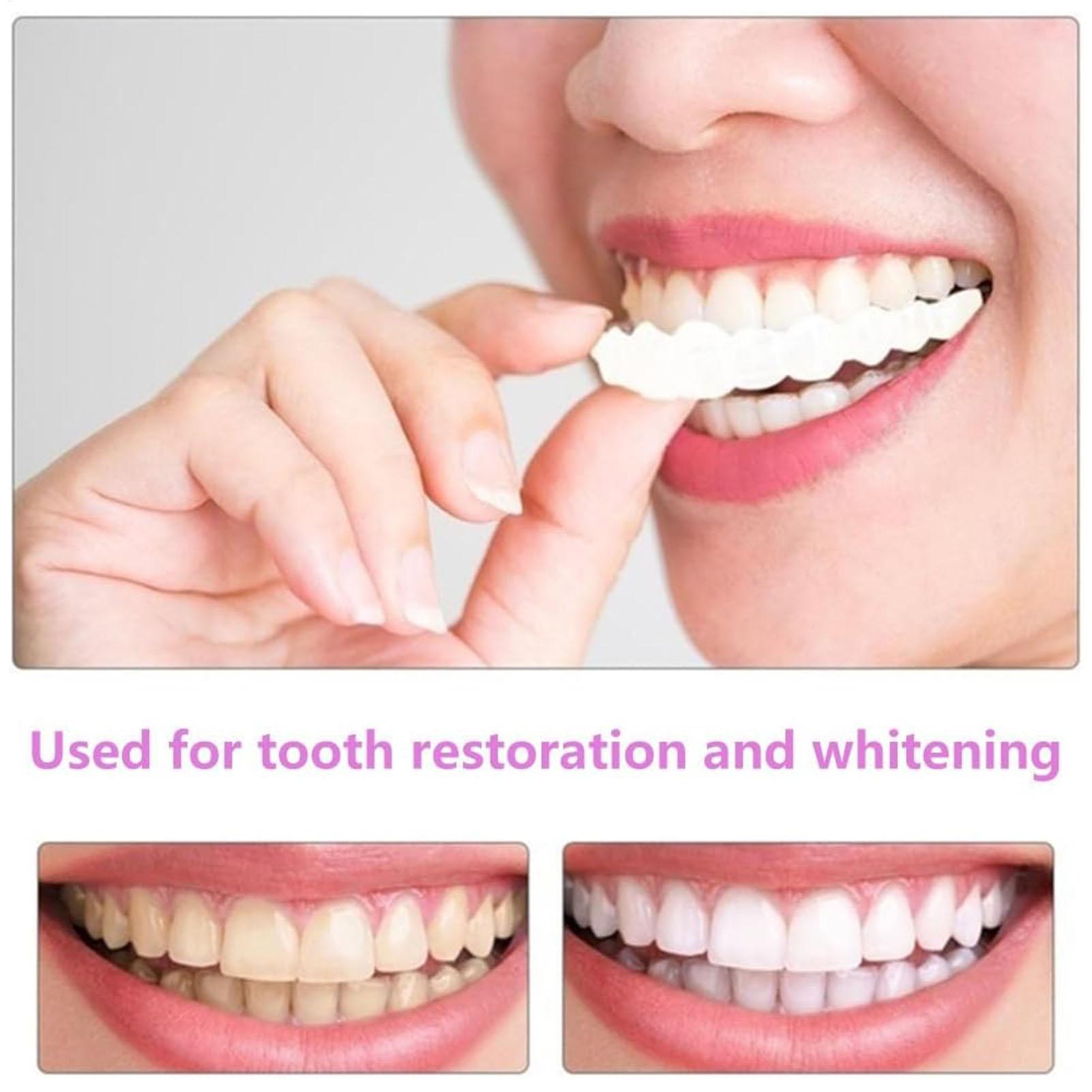 2pcs Veneer Gigi Temporer Pria - Teeth Whitening Veneers ulasan dan harga
